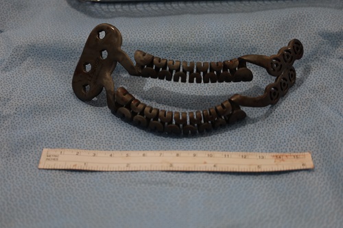 Cirurgia_toracica_reconstruccio_mama