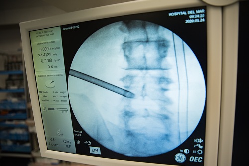 Neurocirurgia